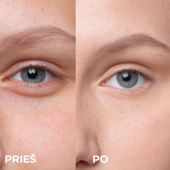 SKINLOVERS 4E Intensyvus Atstatomasis Kremas Paakių Zonai | Stiliauskodas.lt